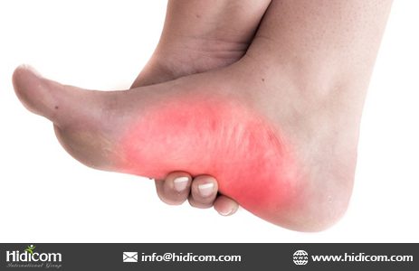 Forefoot pain \u0026 Gout – orthopedic 
